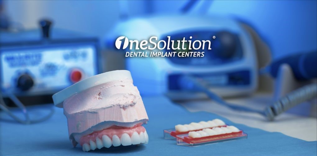 All on 4 Dental Implants - OneSolution